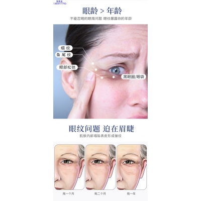 宜宾市_美容院玻尿酸微针眼贴